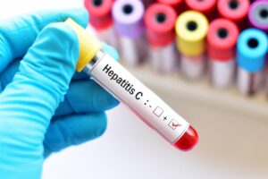 Epatite C, screening gratuito con l’Asl Al